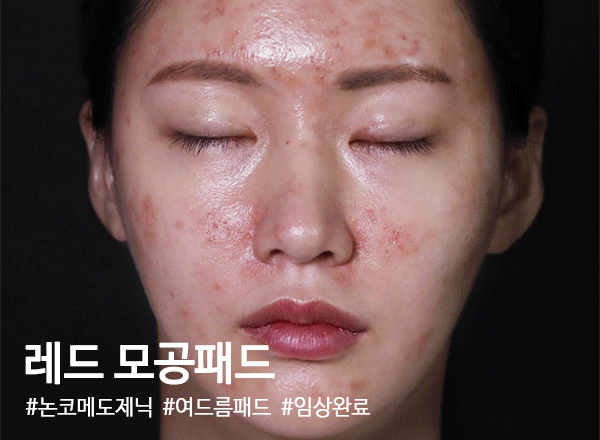 레드모공패드